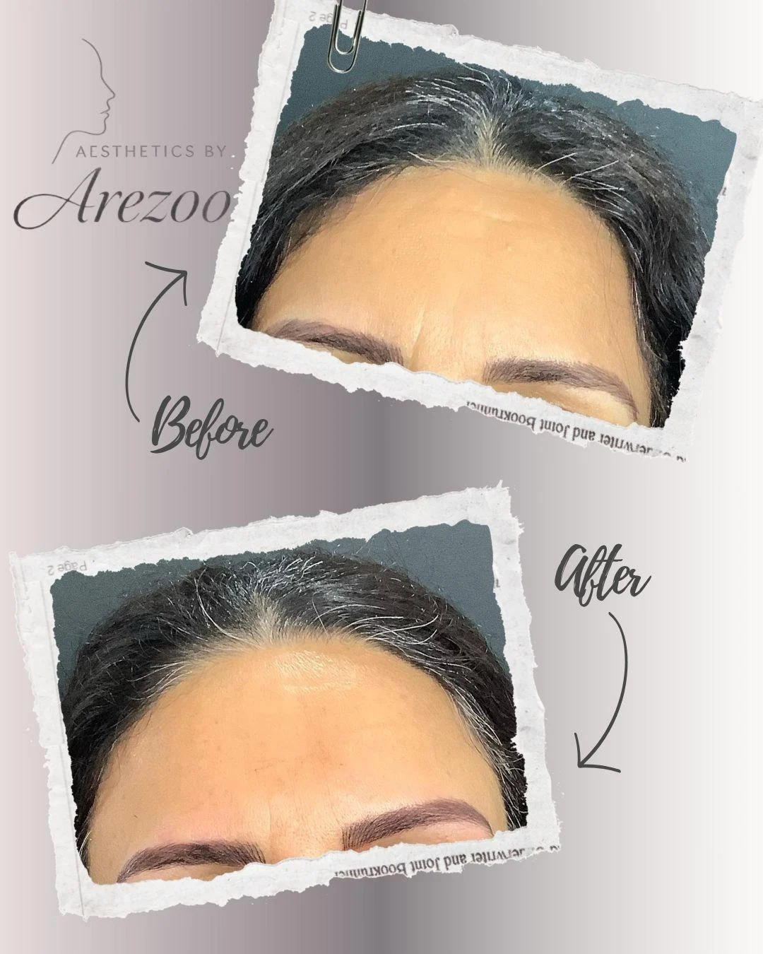 arezo-gal8
